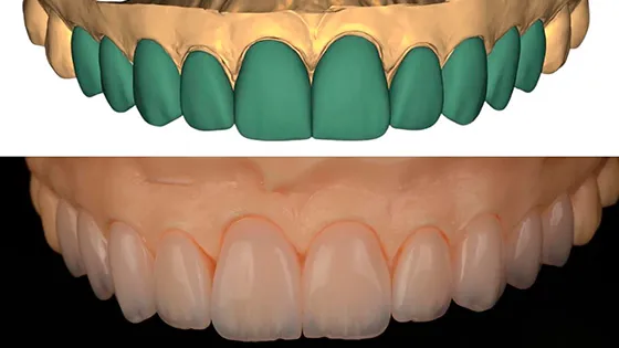 Ortodontia Digital: Alinhamento Preciso e Rápido.